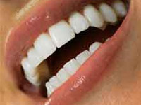 СО2-лазеры в стоматологии: объять необъятное