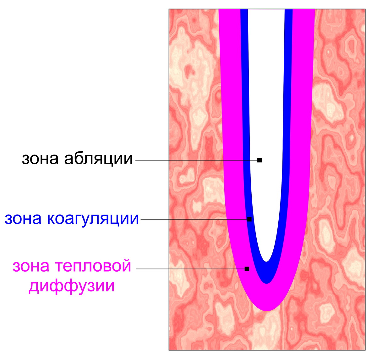 Лазерное воздействие на кожу skinlift ru